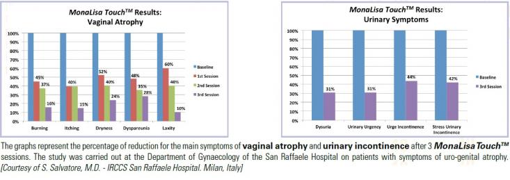 image Monalisa touch research findings